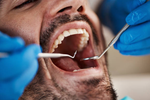 Best Emergency Dental Care for Sports Injuries in West Van Lear, KY
